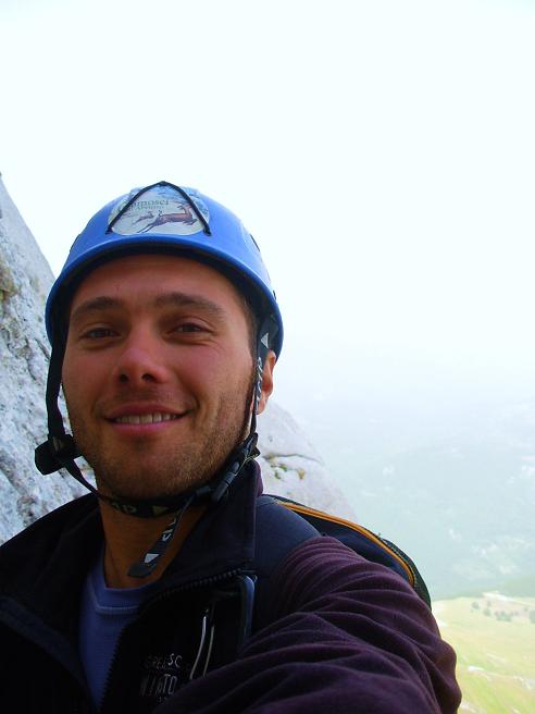 Sintomi di psoriasi sui gomiti di fotografia